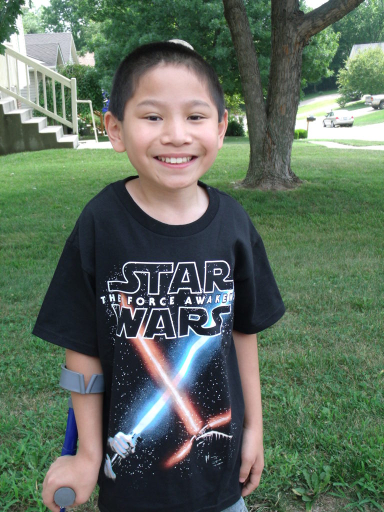 Photo of Spencer, a child adopted through Holt, at 11 years old using a crutch and smiling.