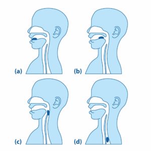 Illustration of person swallowing