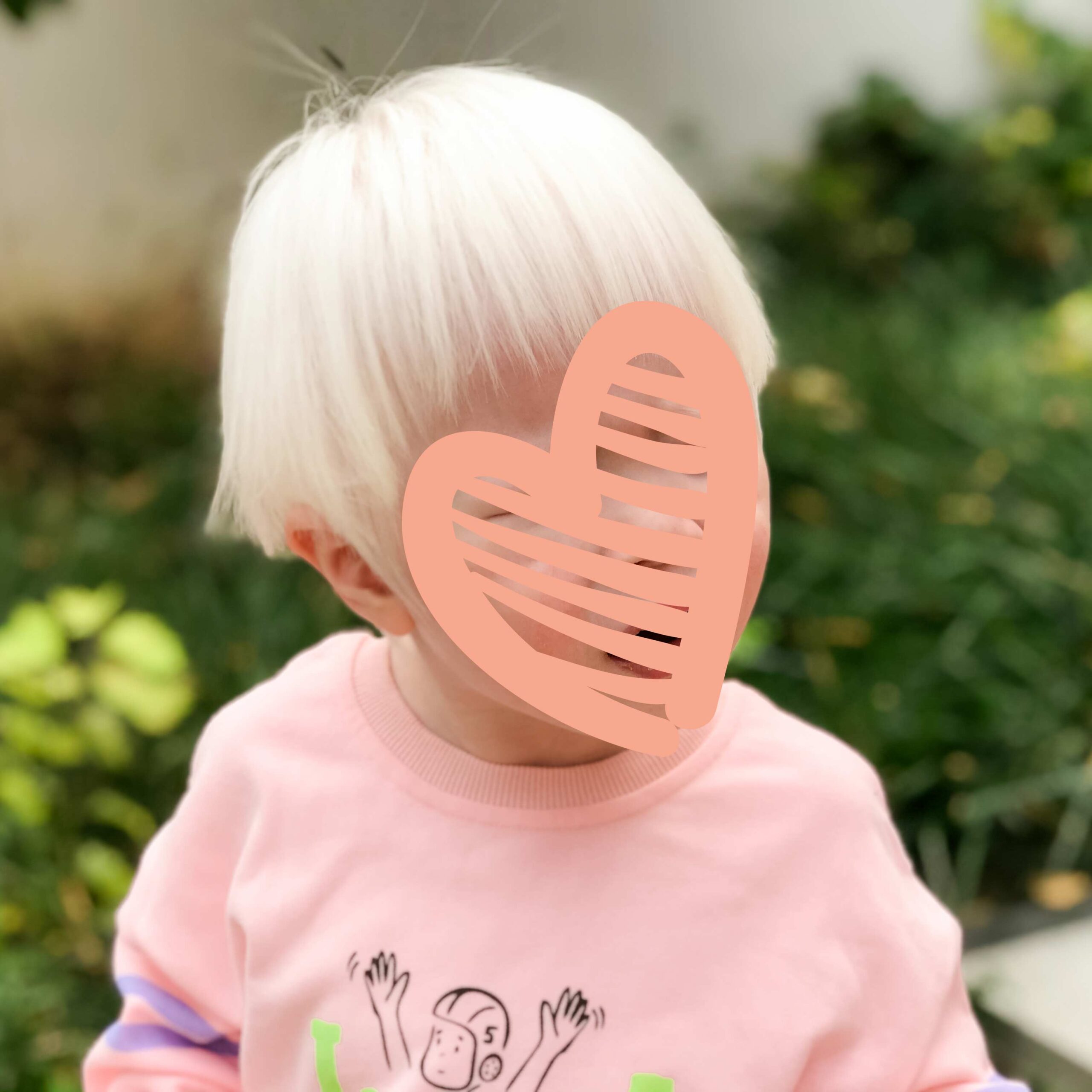 a young girl with albinism in China 