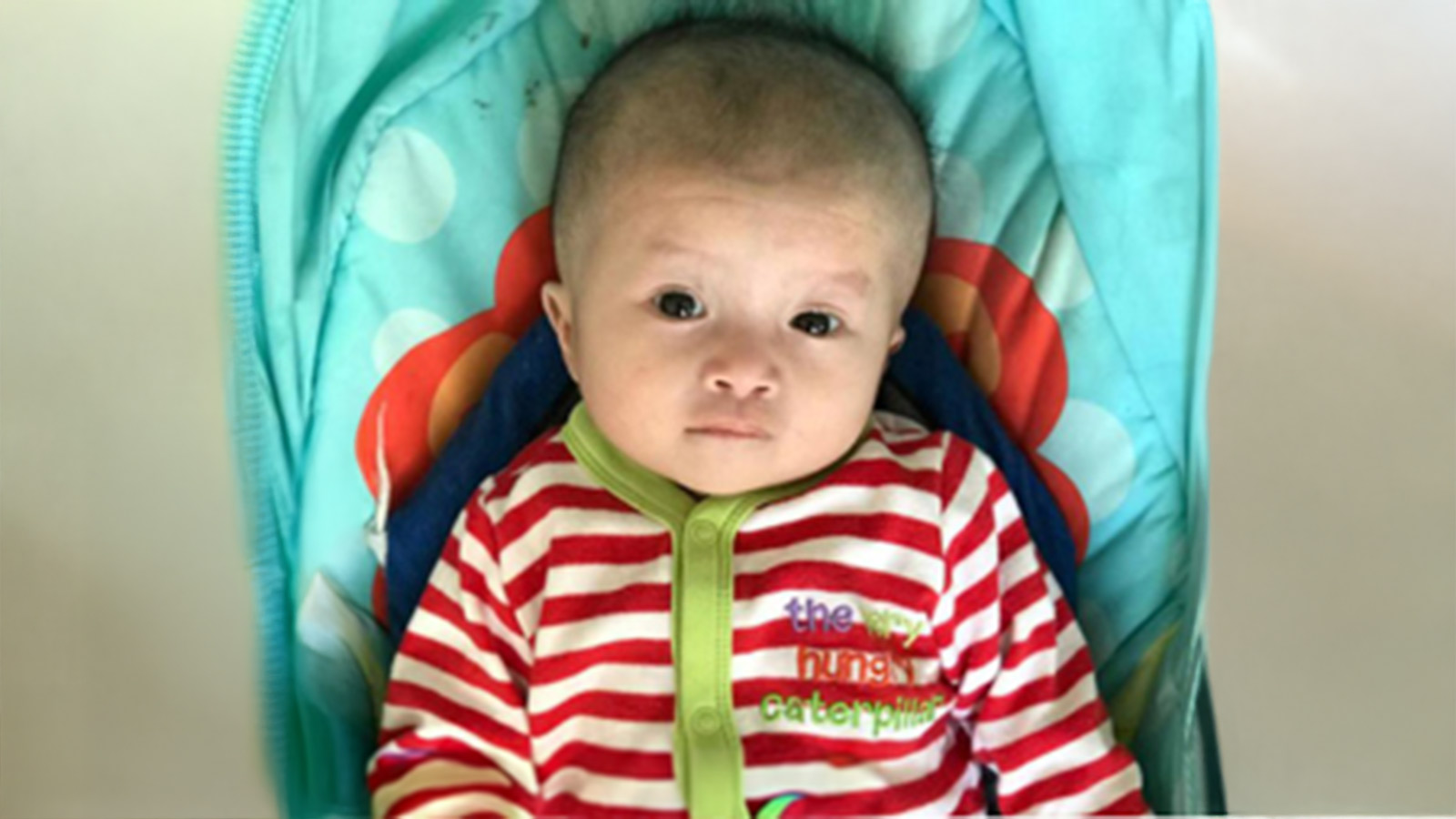 a child who has heart surgery lays on a blanket in china