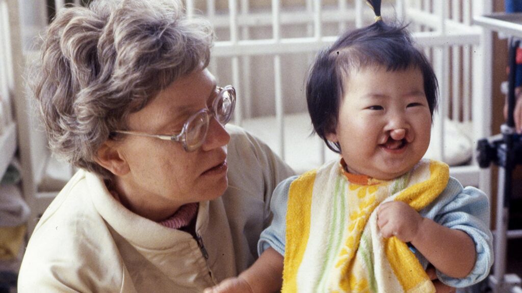 molly holt holds a child with cleft lip in south korea