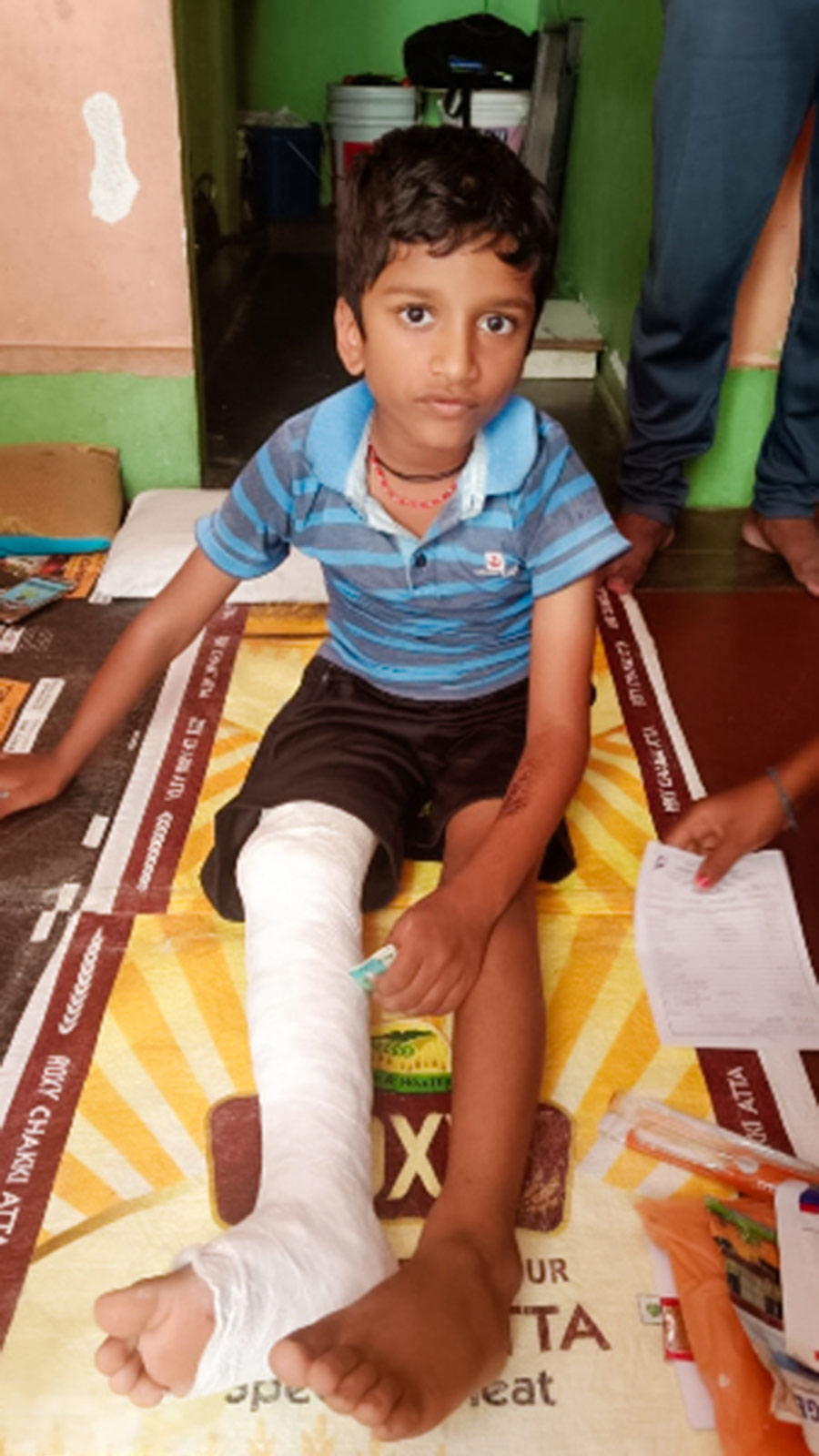 a boy sits on a table with a broken leg in a cast in India