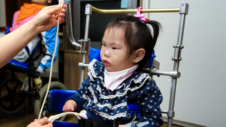 a girl in a blue sweater receives nourishment through a feeding tube at Ilsan in Korea